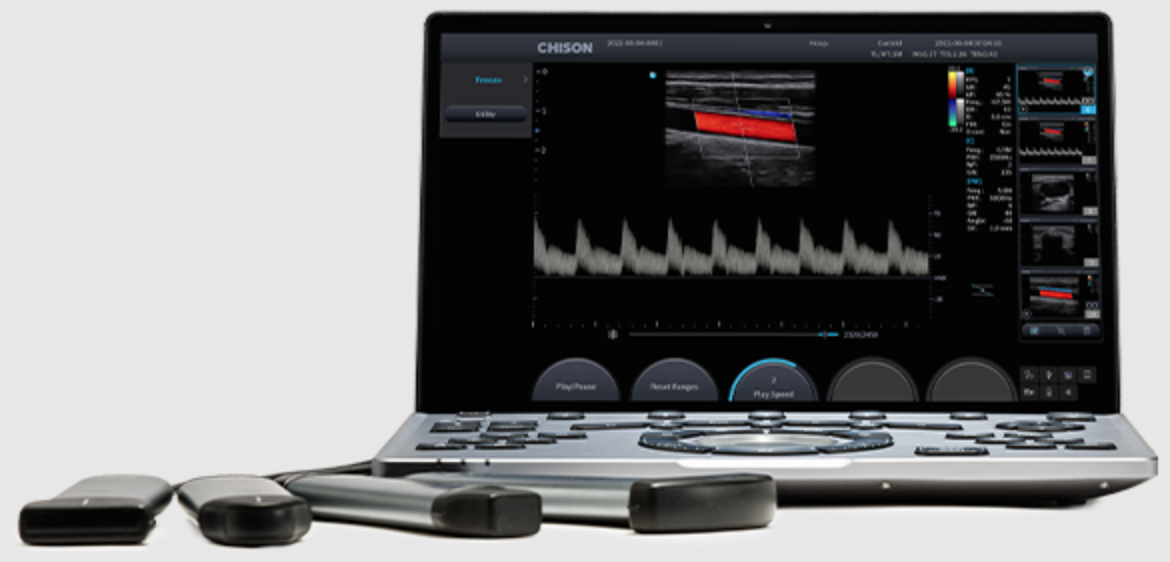 The world’s lightest and thinnest laptop ultrasound