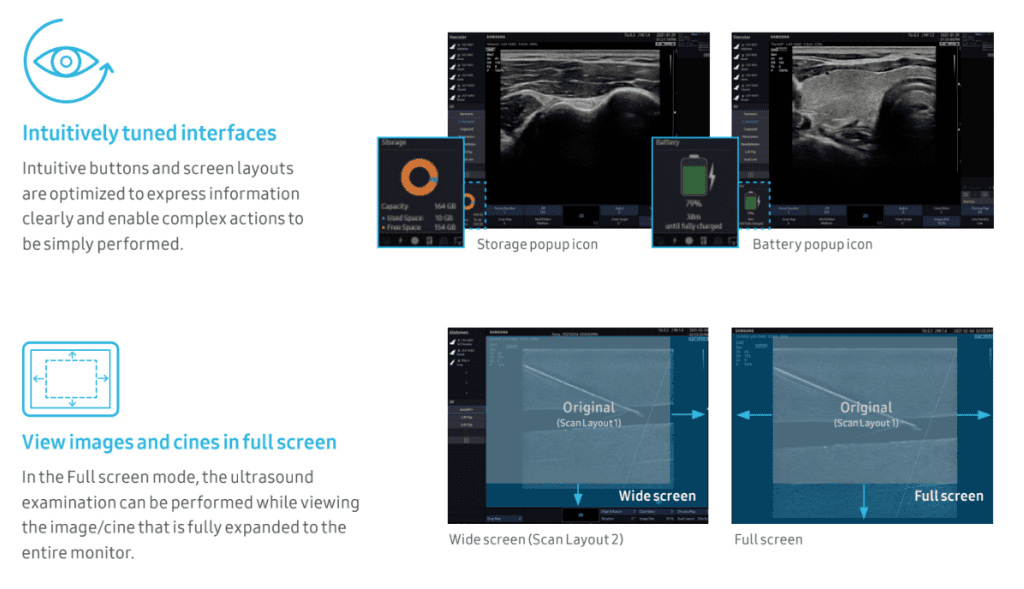 HM70 EVO veterinary ultrasound by samsung for equine