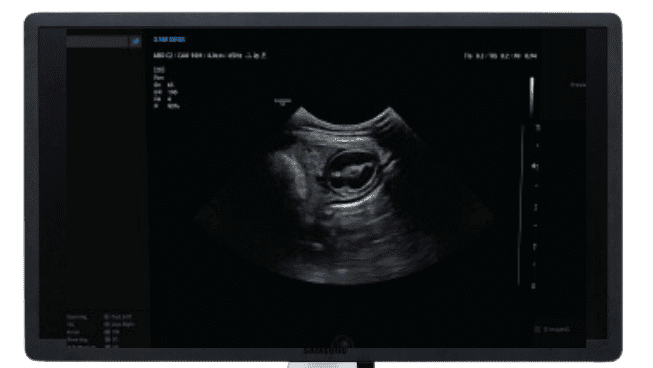 Samsung V8 ultrasound veterinary